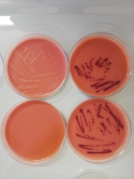 Cromogeno coli